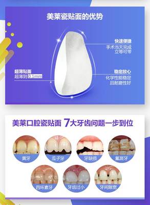 瓷貼面 開啟您的亮白眼妝新紀元——長沙流行款超博3D貼面推薦